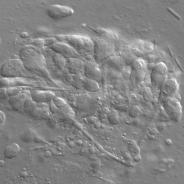Plasmodium of developing Myxobilatus 11M21 myxospores.