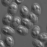 Myxobolus spores from the gallbladder of redside shiner.