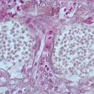 Dermocystidium in cysts