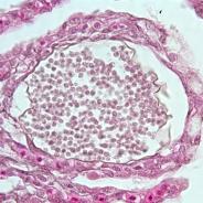 Dermocystidium in cysts