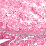 Boundary between host and glugea xenoma