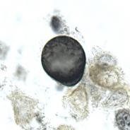 Ichthyobodo in fish skin smear.