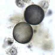 Ichthyobodo in fish skin smear.