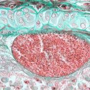 Loma cyst in gill filament.