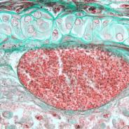 Loma cyst in gill filament.