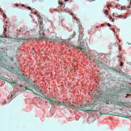 Loma cyst in gill filament.