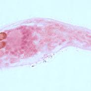 Sanguinicola blood fluke miracidium