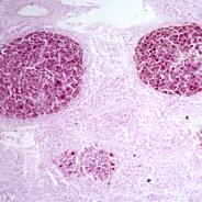 Tissue section showing mycobacterium lesion in sculpin.