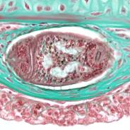 Tissue section showing a trematode metacercaria in steelhead gill filament.