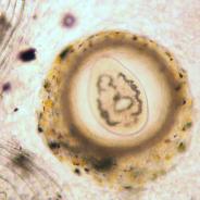 Trematode metacercaria from skin of trout.