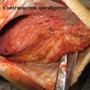 Contracaecum nematodes in mesenterial membranes.