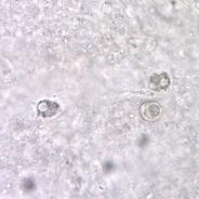 Amoeba in gill.