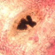 Trematode (Family Heterophyidae) developing within gill filaments.