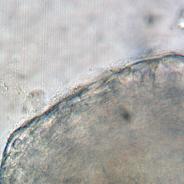 Filamentous flavobacteria on surface of gill.