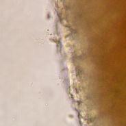 Filamentous flavobacteria on surface of gill.