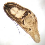 Adult trematode from intestine.