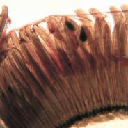 Cysts of Myxobolus spores in gill filaments.