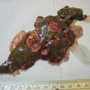 Fish liver showing areas of necrosis and damage due to systemic Ceratomyxa shasta infection.