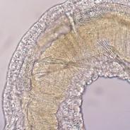 Manayunkia sp. polychaete with microsporidian infection.