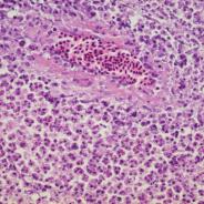 Tissue section showing Ceratomyxa shasta myxospores developing in intestinal wall.