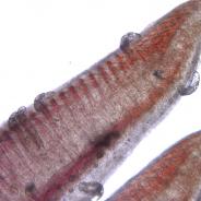 Dactylogyrus on gill filaments.