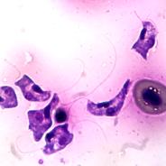 The blood pathogen Cryptobia