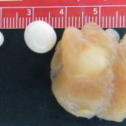 Henneguya cysts from muscle tissue.