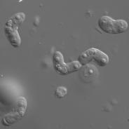 Mature Ceratomyxa shasta myxospores.