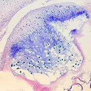 Myxobolus cerebralis developing in head cartilage.