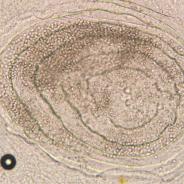 Myxobolus squamalis cyst under fish scale.