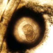 Neascus metacercaria surrounded by dark pigment.