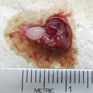 Bluegill heart with white trematode metacercariae.