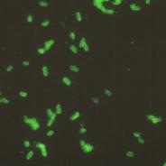 Fluorescence microscopy image of renibacterium cells.