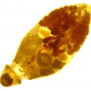 Adult trematode filled with eggs.