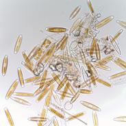 Diatoms: commonly seen in skin scrapes of fish.