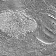Adult trematode ruptured out of metacercaria.