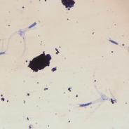 Triactinomyxon spores of M. cerebralis.