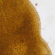 Close-up of cilliated edge of adult sanguinicolid fluke.