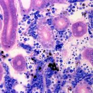 Aeromonas damage to kidney tissue.