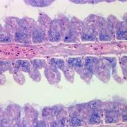 Flavobacterium (thin filaments) adhering to gill epithelium.