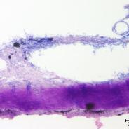 Flavobacterium (thin filaments) adhering to fish skin.