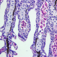 Gill tissue infected with virus