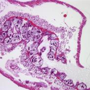 Pansporocysts of M. cerebralis actinospores developing in gut wall of worm host.
