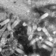 Electron micrograph of VHSV particles