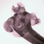 Anterior (head) end of adult Phyllobothrium sp. cestode.