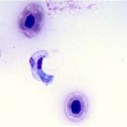 Stained blood smear showing the hemoflagellate Cryptobia salmositica.