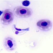 Stained blood smear showing the hemoflagellate Cryptobia salmositica.