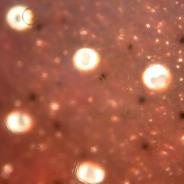 Nanophyetus metacercaria glow brightly where they let light through a thick tissue squash.