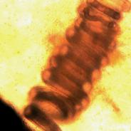 Coiled nematode worm.