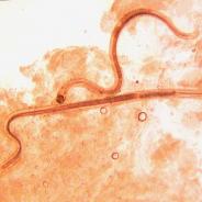 Adult Camallanus nematodes.